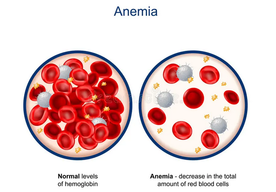 كم نسبة الهيموجلوبين الطبيعية للأطفال؟